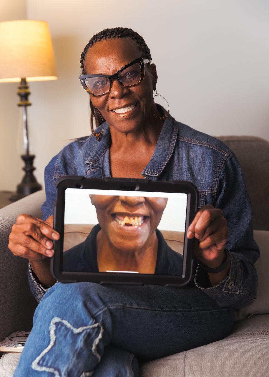 Before-and-after dental implants for a real Old Betsy Dental patient — her restored smile, Keene TX